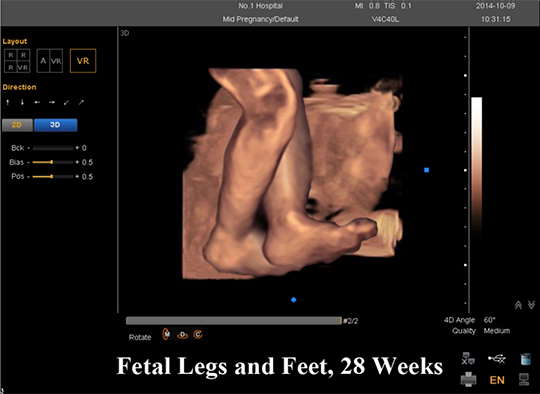fetal legs and feet,28 weeks